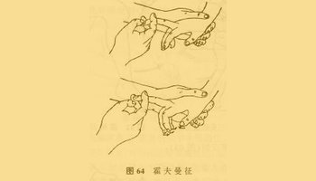 检查方法 霍夫曼征(hoffmann):使病人腕部稍为背伸,手指微屈曲,检查