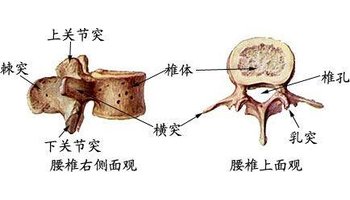 腰椎穿刺术