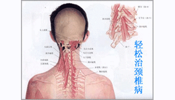 颈椎疾病