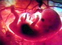 （图）胎儿发育