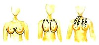 （图）乳房按摩